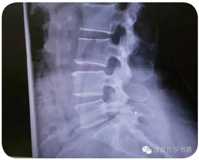 跑步与骑行不当带来的运动伤害-第4张图片-体能网