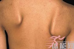 典型的运动模式-第3张图片-体能网 典型的运动模式-第3张图片-体能网