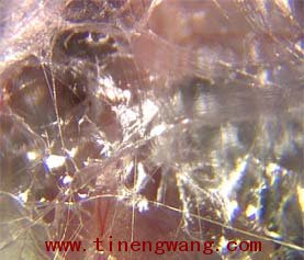 筋膜的解剖、生理功能和训练方法的概述-第2张图片-体能网 筋膜的解剖、生理功能和训练方法的概述-第2张图片-体能网