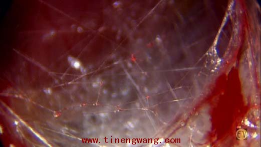 筋膜的解剖、生理功能和训练方法的概述-第4张图片-体能网 筋膜的解剖、生理功能和训练方法的概述-第4张图片-体能网