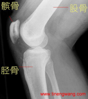 膝关节为什么如此容易受伤-第1张图片-体能网 膝关节为什么如此容易受伤-第1张图片-体能网