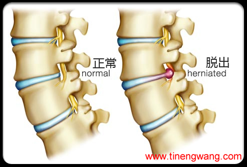 图片来自：medicinenet.com。