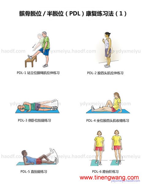 髌骨脱位 髌骨半脱位康复练习法-第1张图片-体能网