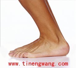 足底筋膜炎-第1张图片-体能网 足底筋膜炎-第1张图片-体能网