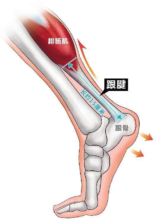 跟腱痛的康复训练和治疗方法-第2张图片-体能网
