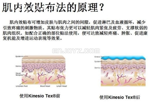 肌内效贴布与一般酸痛贴布有何不同-第1张图片-体能网 肌内效贴布与一般酸痛贴布有何不同-第1张图片-体能网