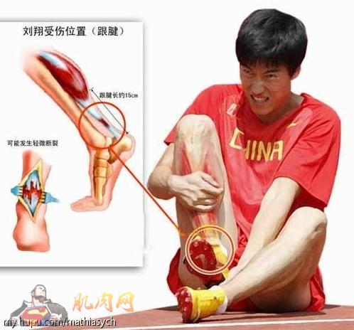 跟腱与弹跳力的关系-第1张图片-体能网 跟腱与弹跳力的关系-第1张图片-体能网