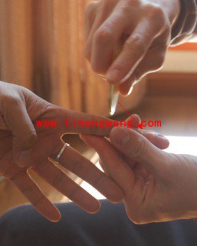 手指肌腱炎的康复方法-第4张图片-体能网