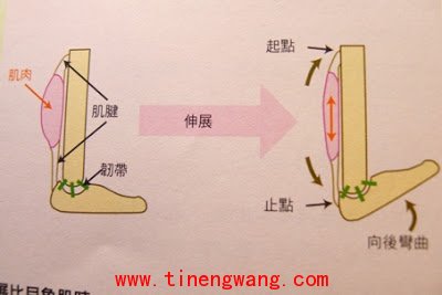 解决足底筋膜炎的三步骤-第2张图片-体能网