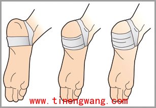 足跟底痛-第2张图片-体能网