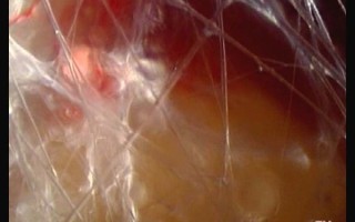 筋膜的解剖、生理功能和训练方法的概述 筋膜的解剖、生理功能和训练方法的概述