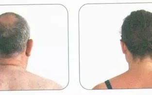 身体纠正训练的17个入门指南 身体纠正训练的17个入门指南