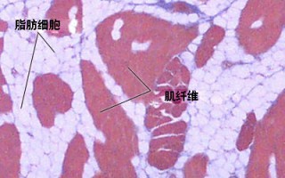 肌肉的结构功能 肌肉的结构功能